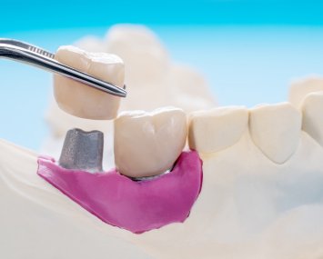 Oral Surgery